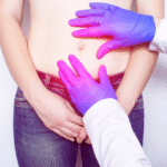 Doctor examining a patient’s abdomen for a possible hernia near the belly button, representing a clinical evaluation before Abdominal Wall Hernia Surgery.