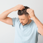 Man examining his scalp in the mirror, concerned about hair loss — potential candidate for a hair transplant.