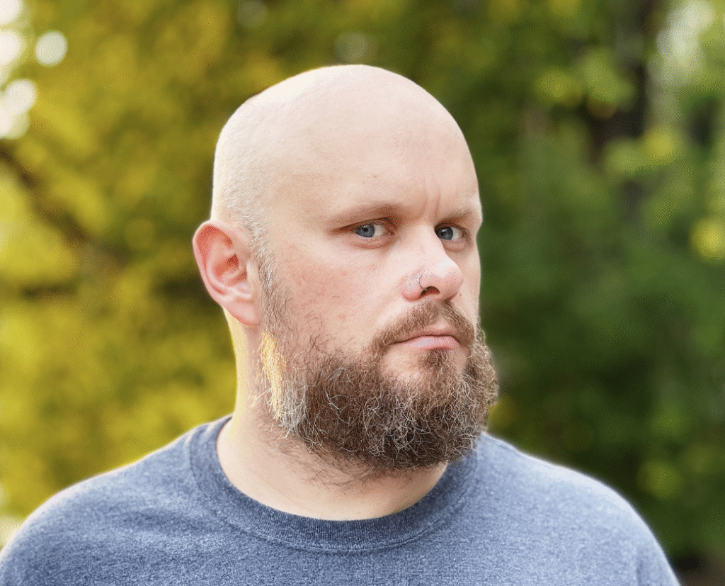 shorter A bald man with blue eyes and a full brown beard, possibly indicating a beard transplant, looks seriously at the camera against a blurred green and yellow background.