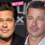 efore and after photos of Brad Pitt, showing a comparison of his face with the keywords "Brad Pitt facelift."