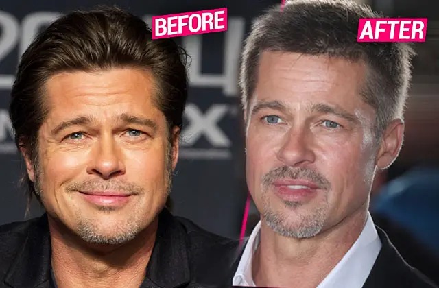 efore and after photos of Brad Pitt, showing a comparison of his face with the keywords "Brad Pitt facelift."