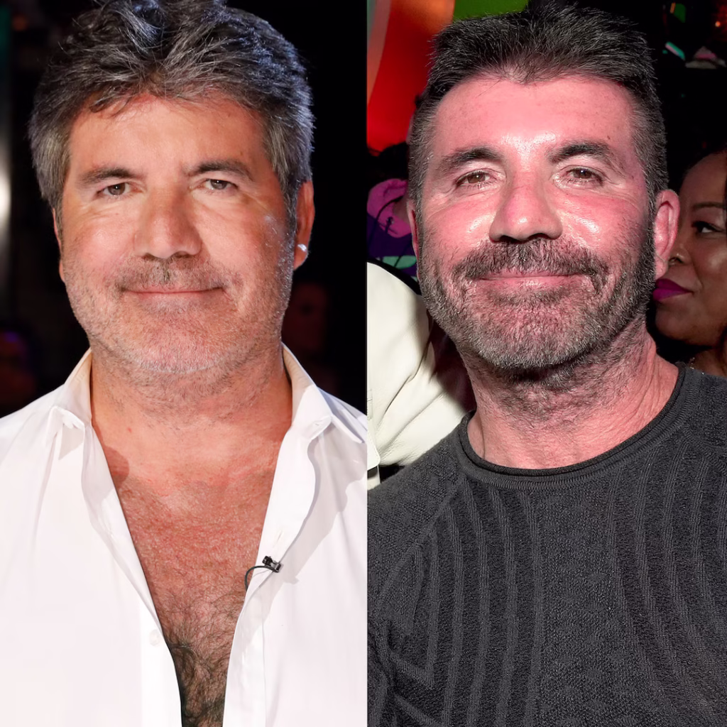 Before and after photos of Simon Cowell, showing a comparison of his face. The "after" image shows Simon Cowell's face appearing tighter.