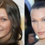 Side-by-side comparison showing Bella Hadid before and after rhinoplasty. The left image shows her younger side profile with a natural nose bridge, while the right image displays her sculpted profile and refined tip after confirming her nose job.