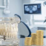 Diagram showing full mouth dental implants secured in the jaw, overlaid with financial symbols representing affordable costs and payment plans.