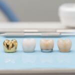 Comparative view of four dental crown materials: Gold alloy, Zirconia, PFM, and Emax ceramic, demonstrating strength and aesthetic options for teeth crowns.